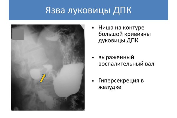 Актуальные ссылки на кракен тор